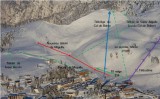 Historique Aiguille